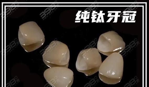 纯钛烤瓷牙一颗要多少钱?_厦门烤瓷牙价格_厦门纯钛合金烤瓷牙多少钱