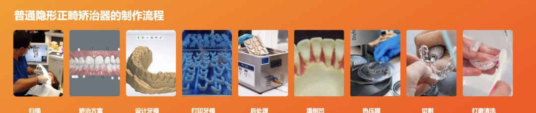 南昌隐形正畸_正畸AI技术_牙齿隐形矫正
